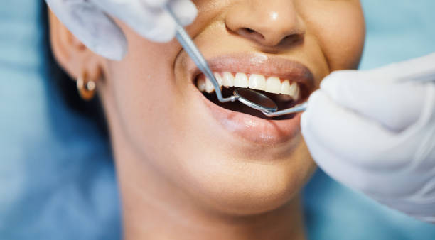 Best Emergency Dentist for Lost Fillings or Crowns in Clay Center, KS